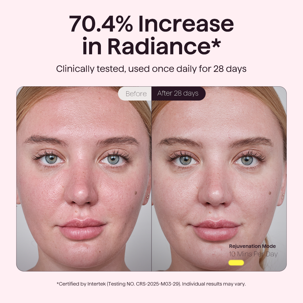 Before and after effect of a skincare product on a woman's face with text about radiance increase.